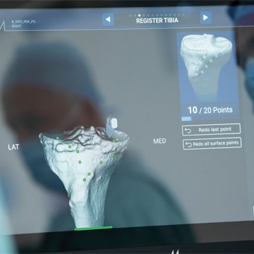 Computer screen showing medical software rendering of tibia