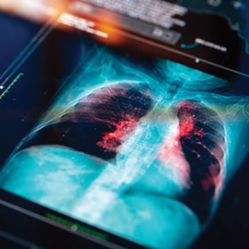 computer screen of digital scan of human chest showing blue torso and red and black lungs