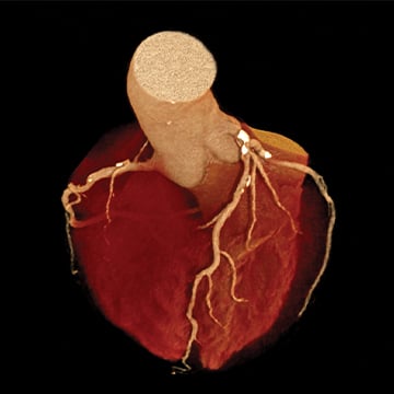 Imaging of a heart on a black background